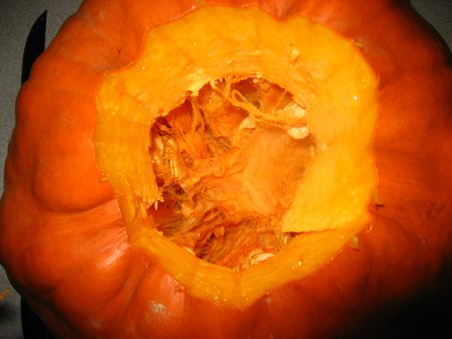 Halloween-Pumpkin-Carving-06-008